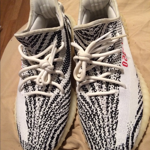yellowing yeezy zebra